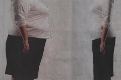 diabetic_surgery