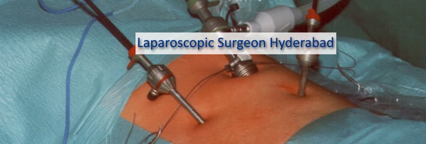 laparoscopic surgeon Hyderabad