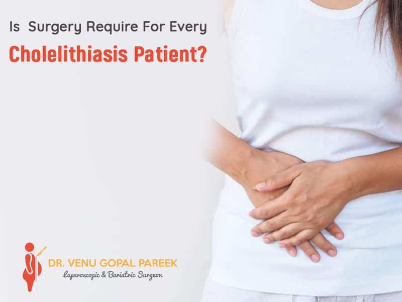 Is Surgery Require for Every Cholelithiasis Patient
