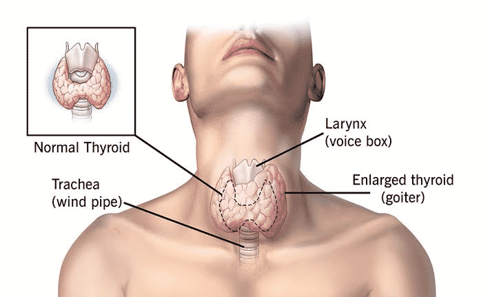 Thyroid Swelling Investigation And Treatment
