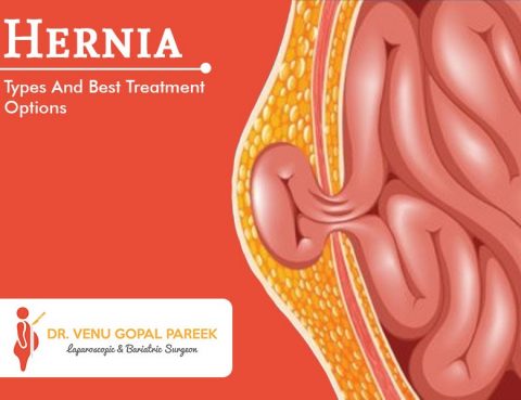 Hernia -Types And Best Treatment Options