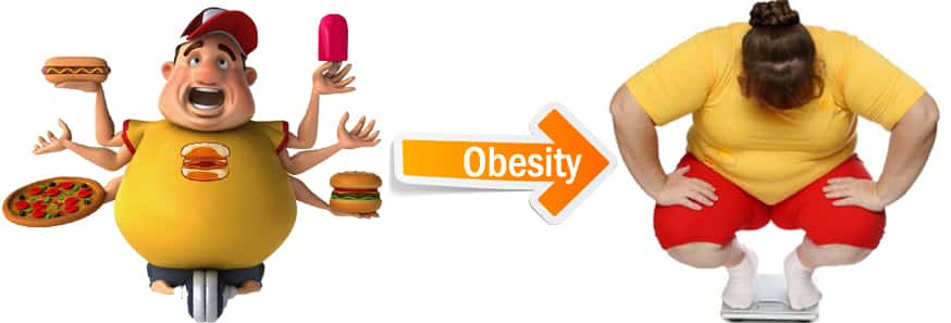 Get Obesity treatment in Hyderabad by Dr V Pareek and reduce your excessive fat and  weight loss