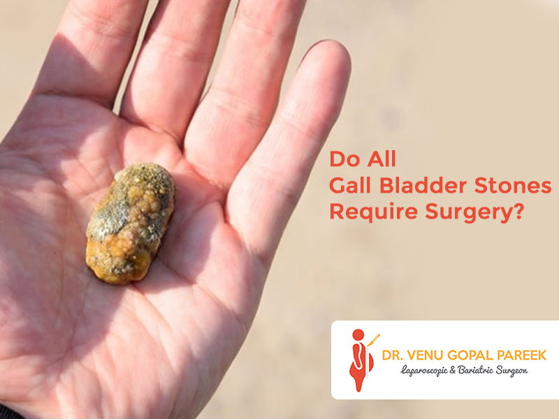 Consult Dr Venugopal Pareek, One of the Best surgeon near me for Gallbladder stone removal surgery in Hyderabad