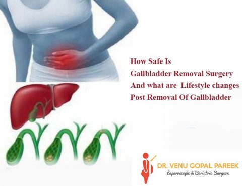 Get today Gallbladder removal surgery by Dr Venugopal Pareek, best Bariatric surgeon in hyderabad