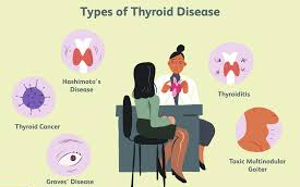 All types of Thyroid diseases treatment by Dr Venugopal Pareek, Best laparoscopic and Thyroid surgeon in Hyderabad