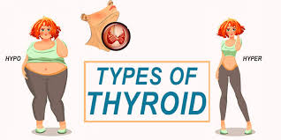 All types of Thyroid diseases treatment by Dr Venugopal Pareek, One of the Thyroid specialist doctor near me