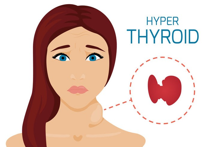Get now Best Hyper Thyroid surgery treatment by Dr Venugopal Pareek, Best Thyroid Doctors in Hyderabad