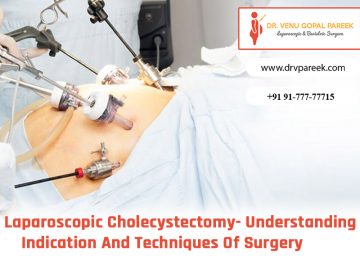 Laparoscopic Cholecystectomy- Understanding Indication And Techniques ...