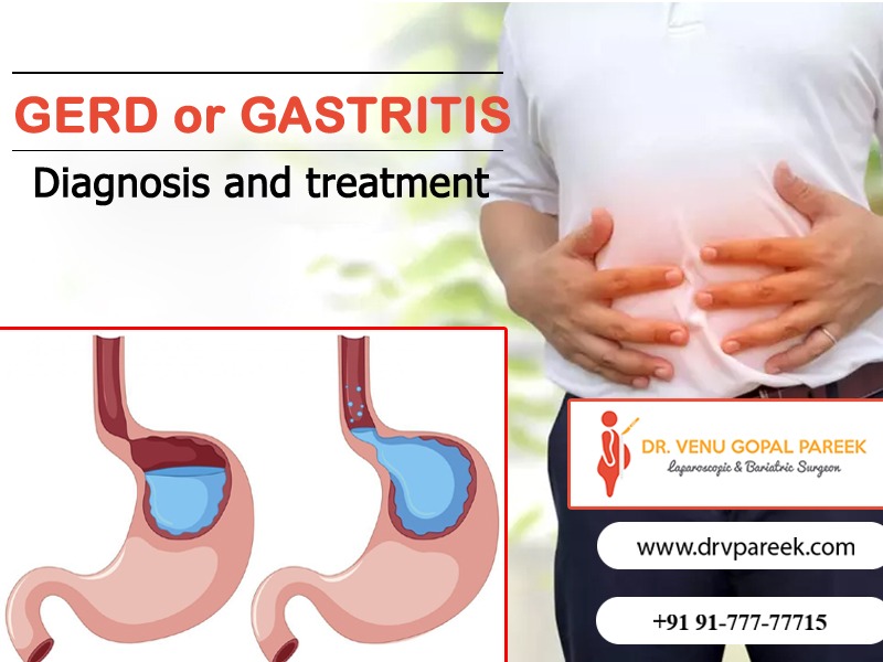 Best GERD Diagnosis and treatment clinic in Hyderabad, gastritis doctor near Secunderabad