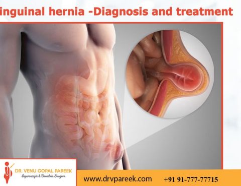 Best Clinic for inguinal hernia diagnosis and treatment in Hyderabad, umbilical hernia doctors near Secunderabad