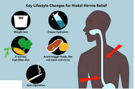 The best lifestyle changes method for hiatal hernia relief by Dr. Venugopal Pareek, hernia center near Secunderabad