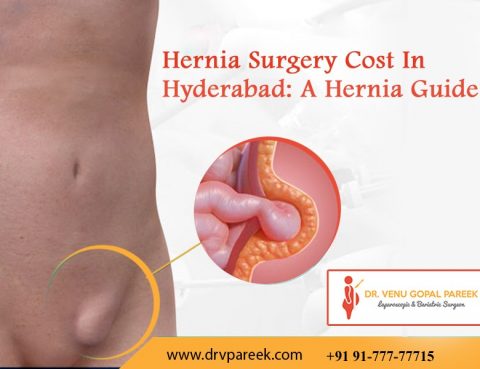 Hernia Surgery Cost in Hyderabad