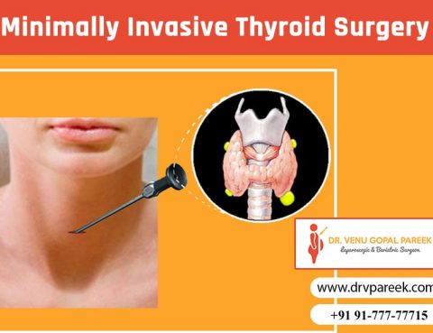 Consult Dr. Venugopal Pareek for minimally invasive thyroid surgery, One of the best thyroid surgeons in Hyderabad