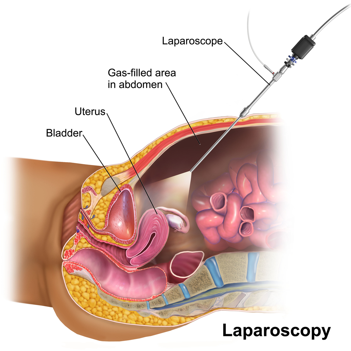 Best Laparoscopic colon cancer surgery Hospital in Hyderabad, Bariatric surgery doctor near me