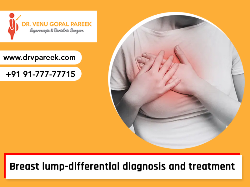 Consult Dr Venugopal for breast lump treatment in Hyderabad, Breast Lump Doctors in Hyderabad