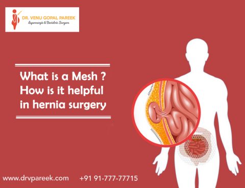 Best Hernia surgery by Dr. V Pareek, One of the best Bariatric and Laparoscopic surgery specialist in Hyderabad