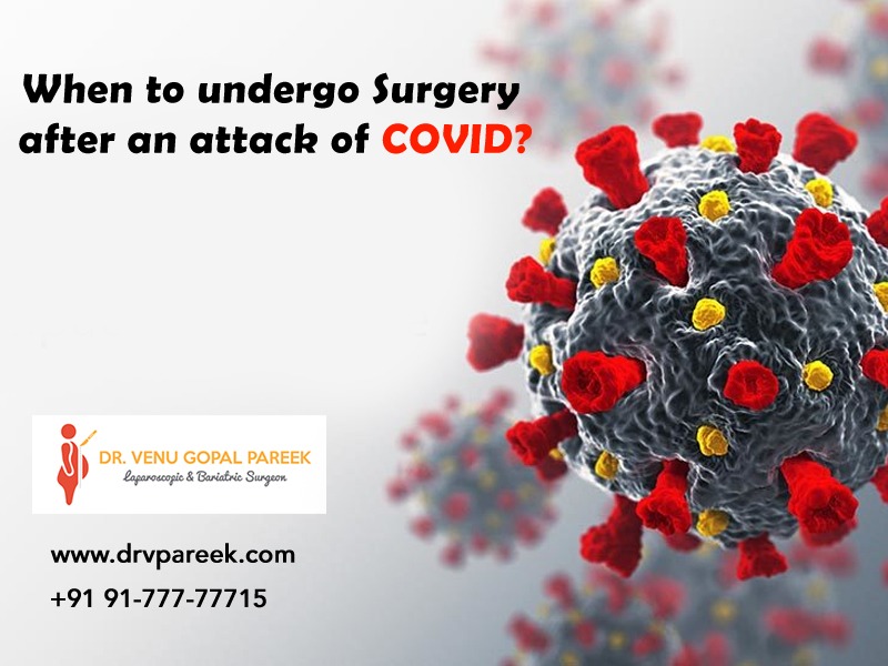 Get now best Bariatric Surgery in Hyderabad by Dr Venu Gopal Pareek, Corona Virus Treatment