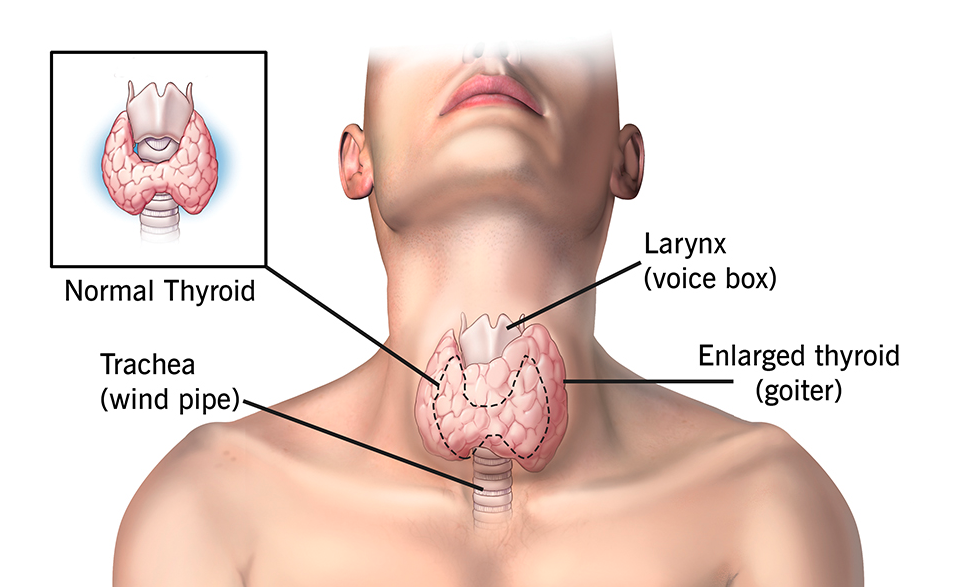 Best treatment for Thyroid surgery by Dr Venugopal Pareek, One of the best thyroid specialist near me