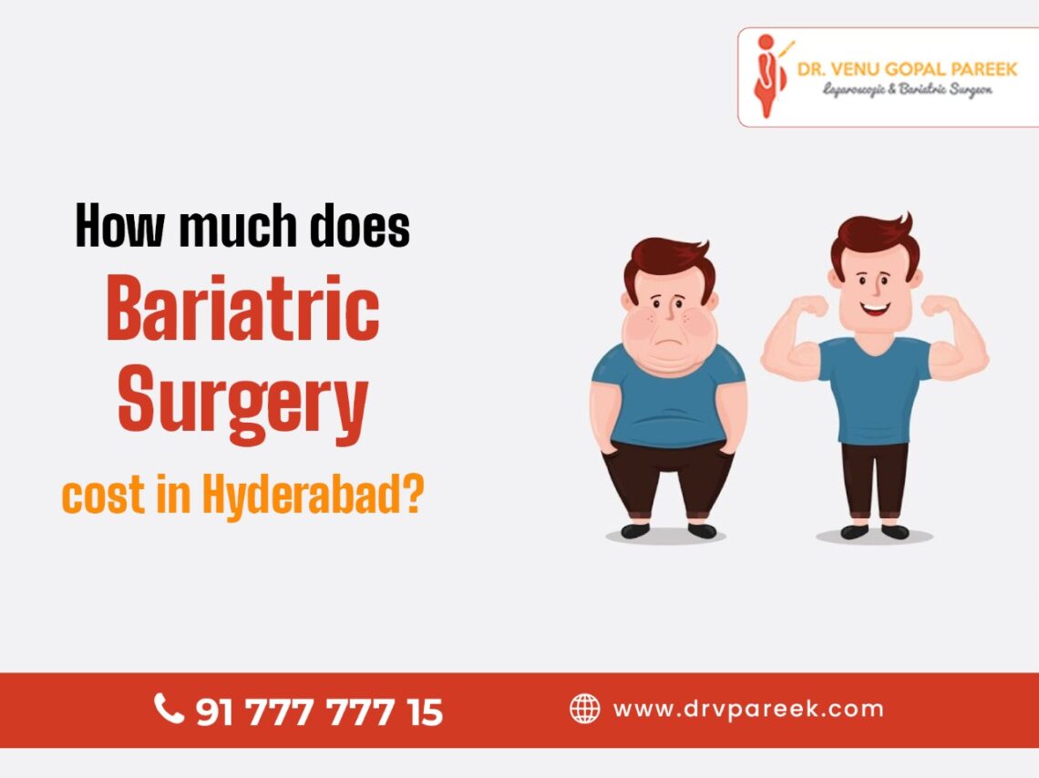 bariatric surgery cost in hyderabad