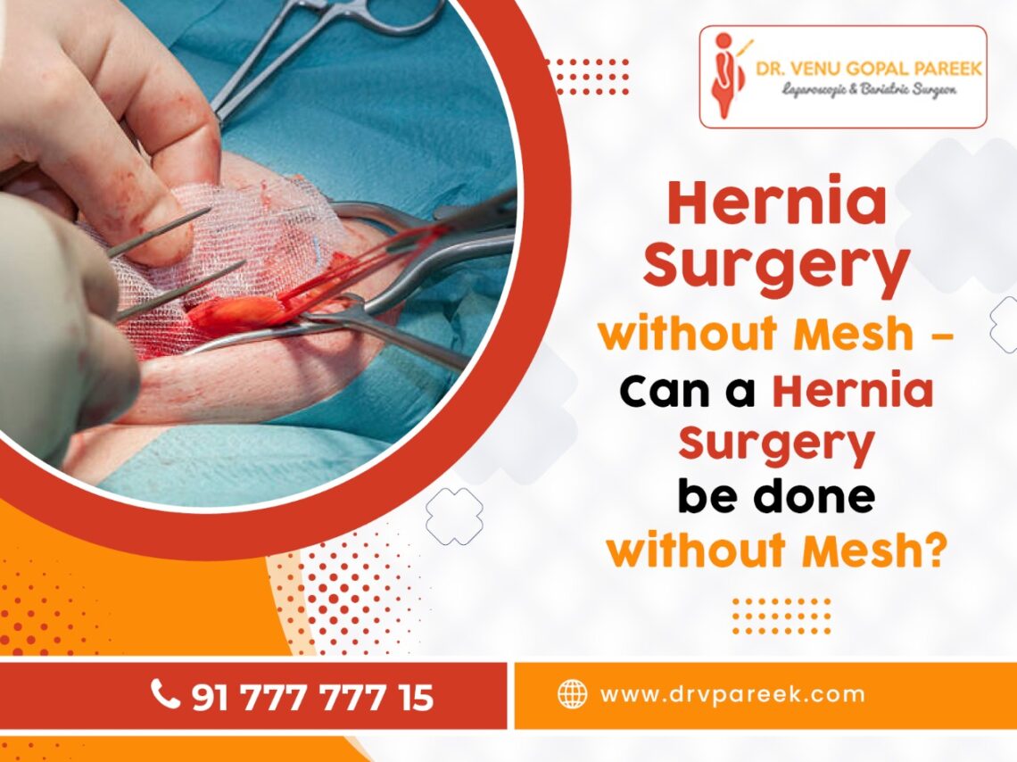 hernia surgery without mesh