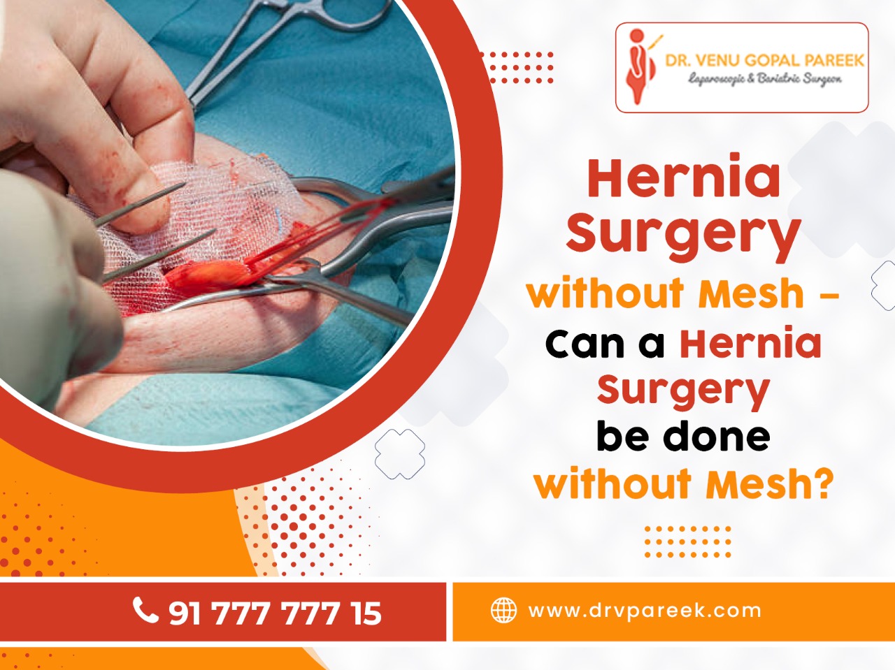 Hernia Surgery Without Mesh Can a hernia surgery be done without mesh?