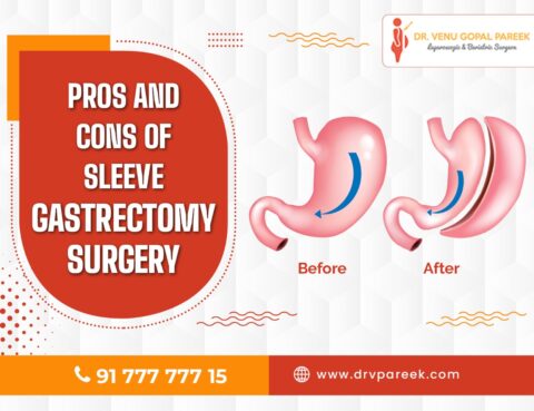 pros and cons of sleeve gastrectomy surgery