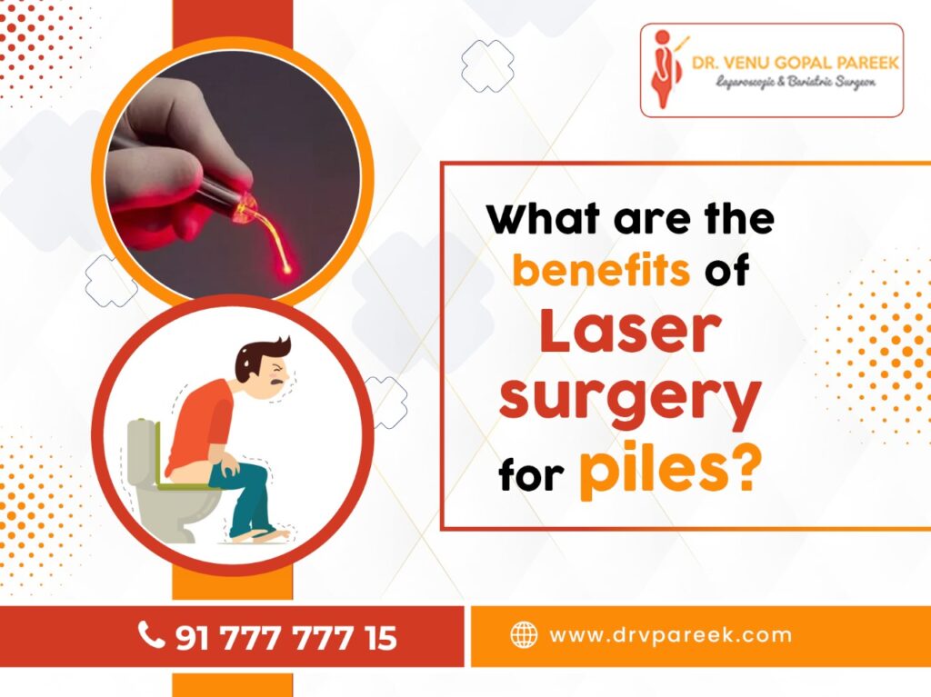 Benefits of Laser Surgery for Piles
