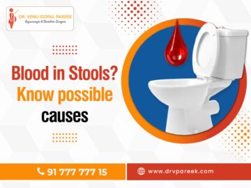 Blood in stools? Know possible causes
