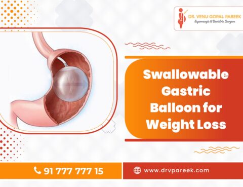 Weight loss treatment with out surgery in hyderabad