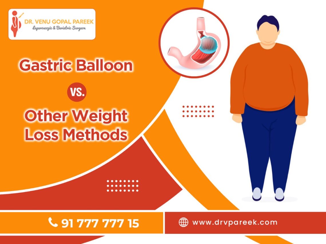 gastric ballon vs other weight loss methods