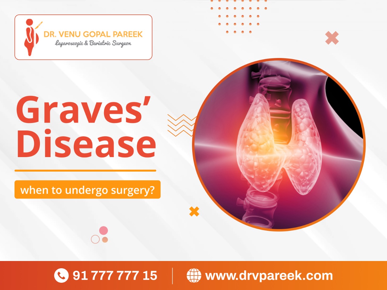 Graves’ disease when to undergo surgery?