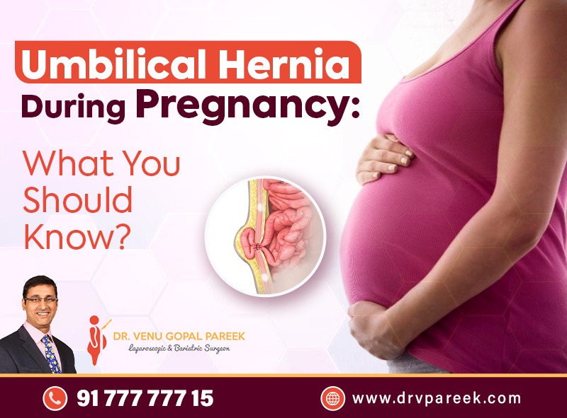 Umbilical Hernia During Pregnancy: What You Should Know ?