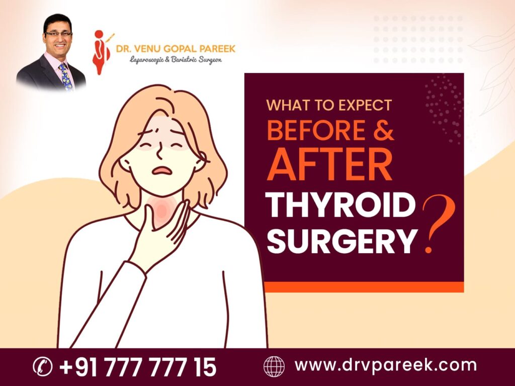 What to Expect Before and After Thyroid Surgery?