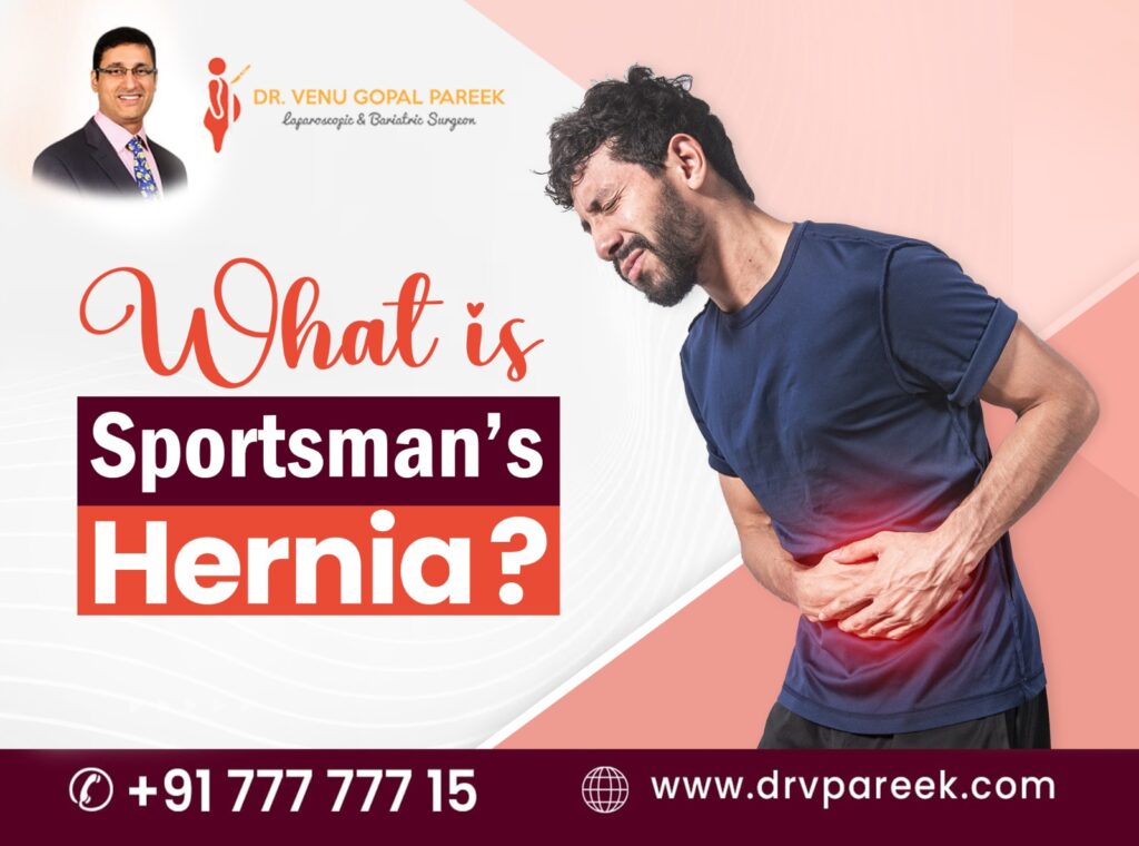 What is a sportsman’s hernia